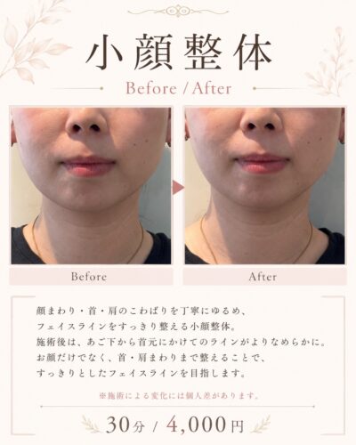 小顔整体メニュー